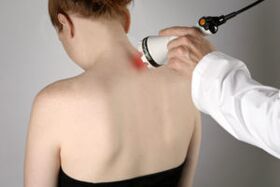 Laser therapy