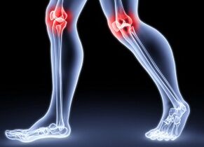 Reasons for developing knee arthrosis